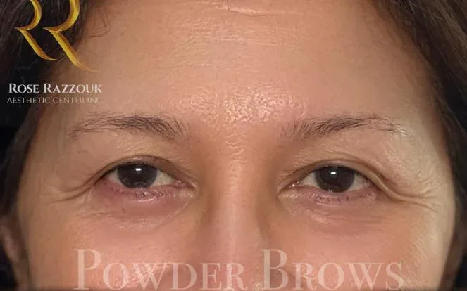Powder brows before treatment